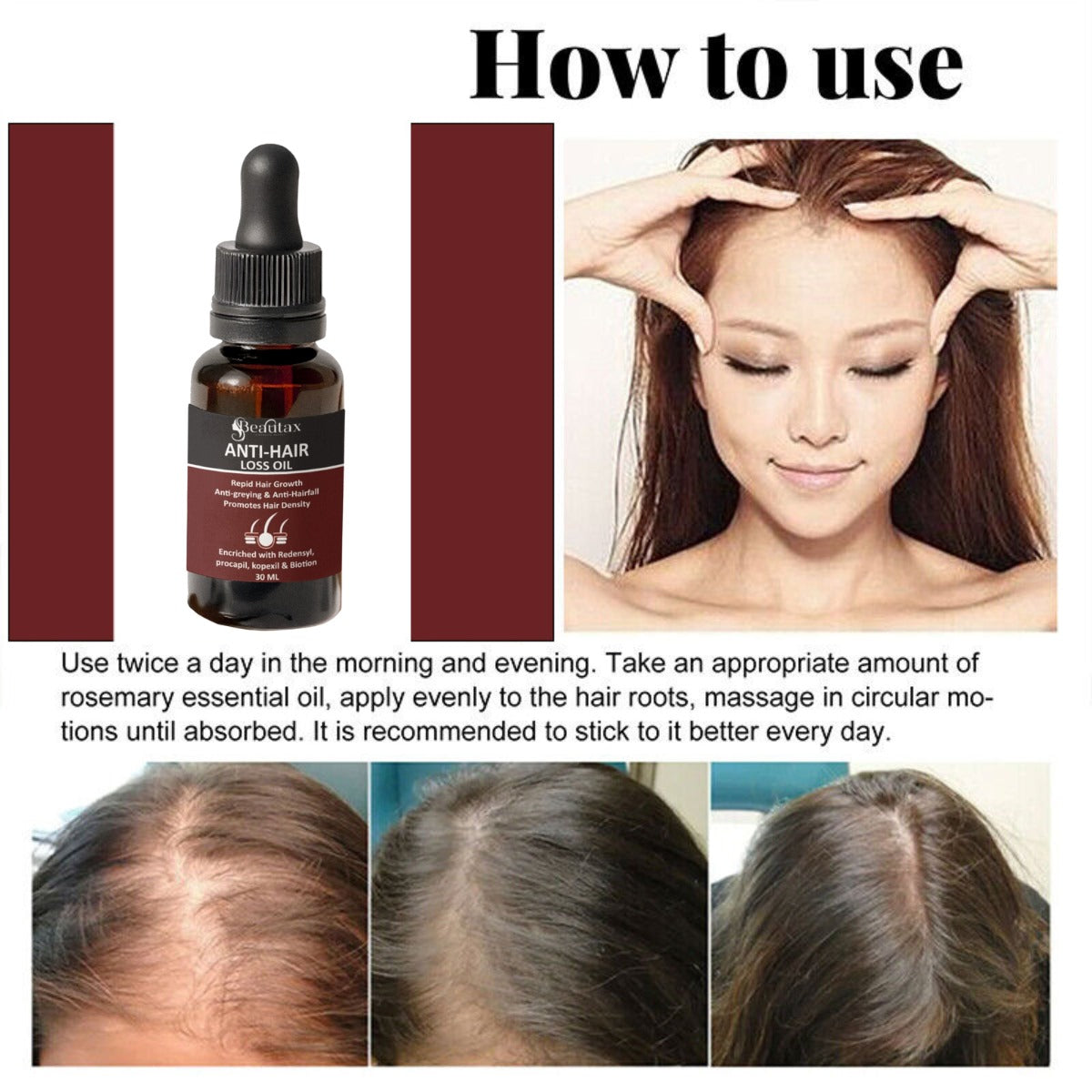 ANTI HAIR LOSS OIL (30ML)
