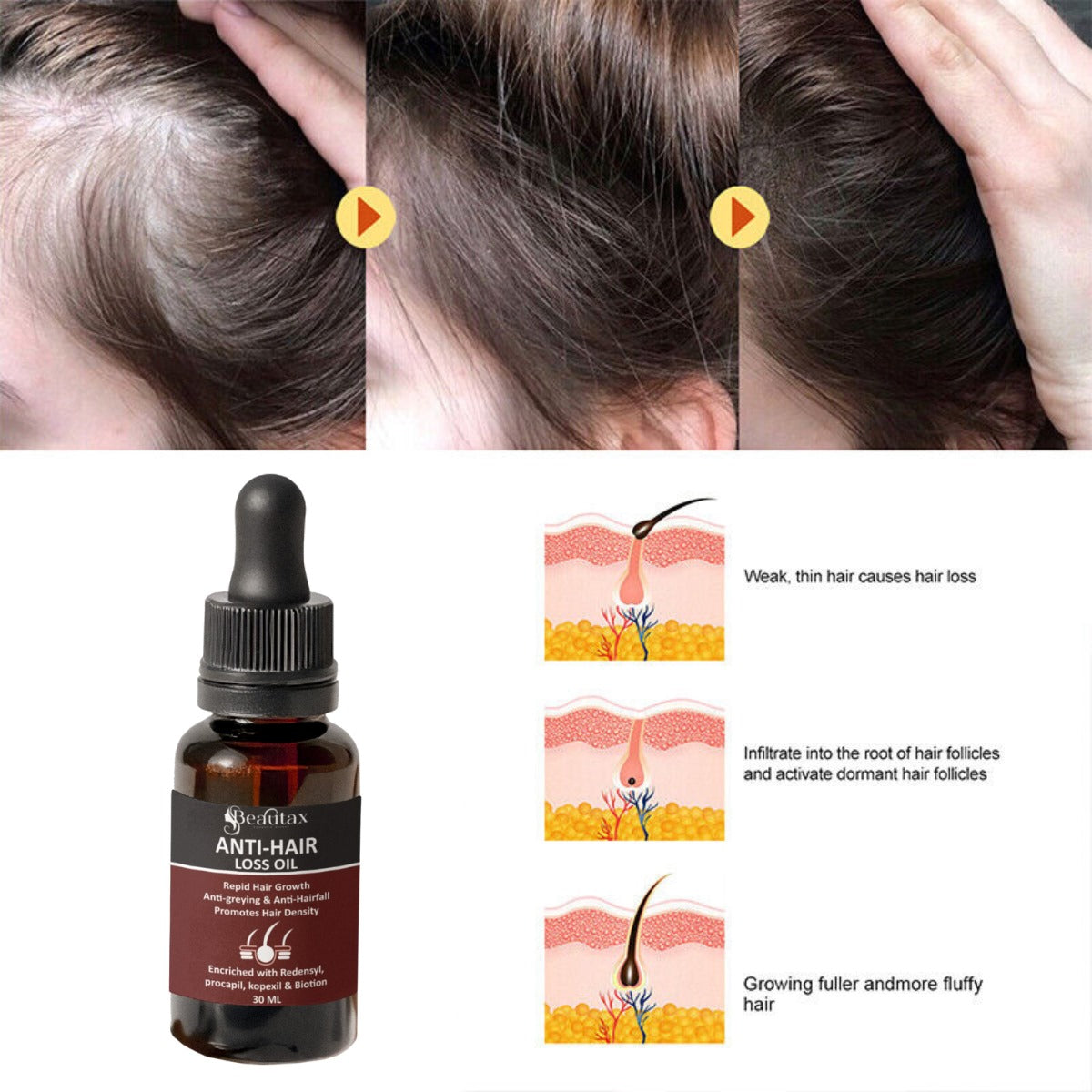 ANTI HAIR LOSS OIL (30ML)