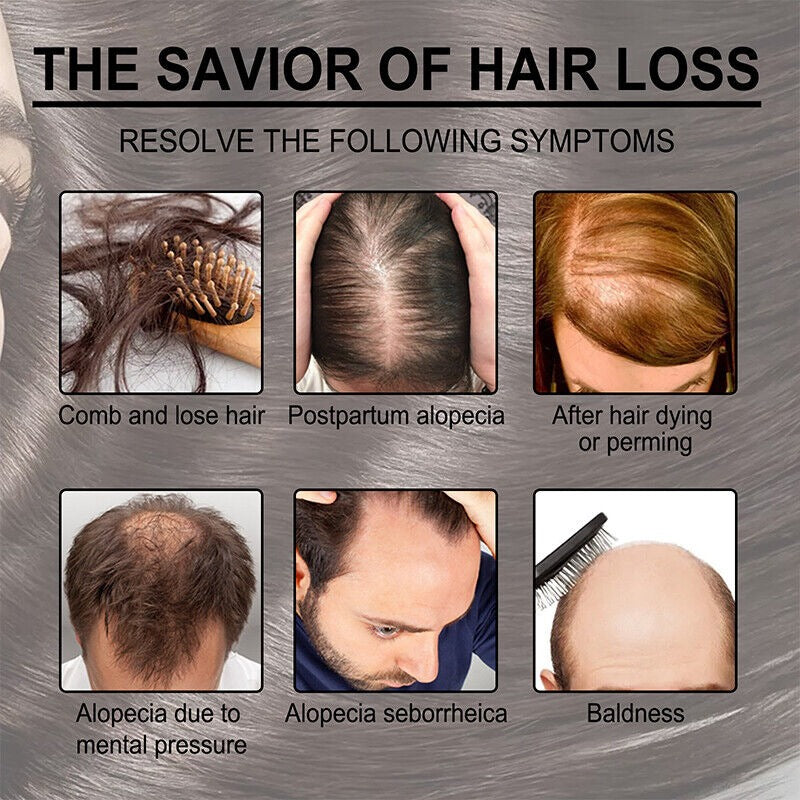 ANTI HAIR LOSS OIL (30ML)