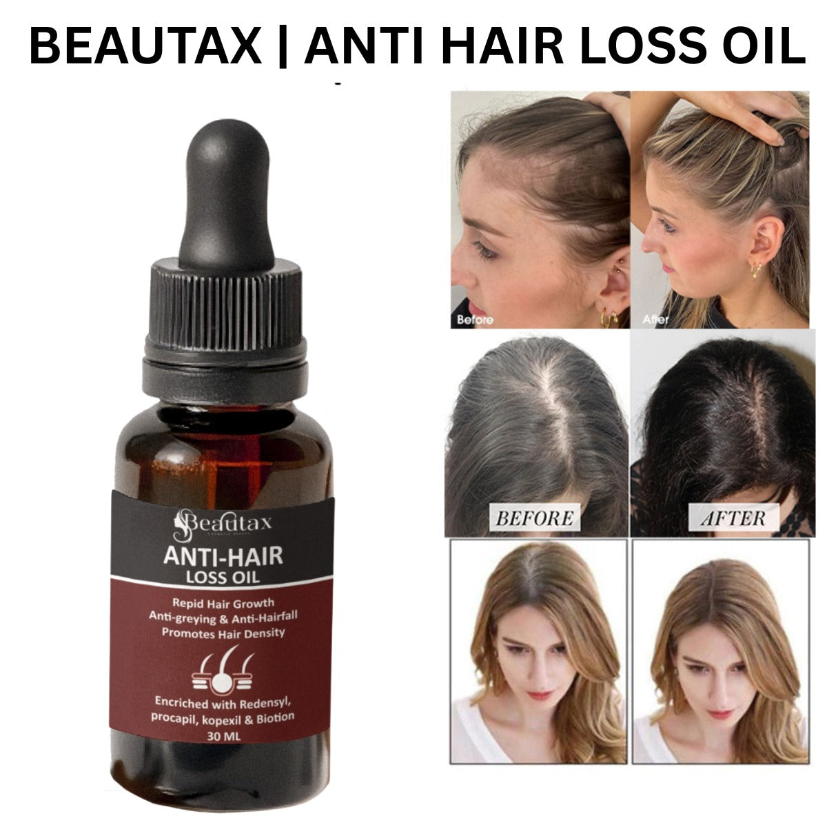ANTI HAIR LOSS OIL (30ML)