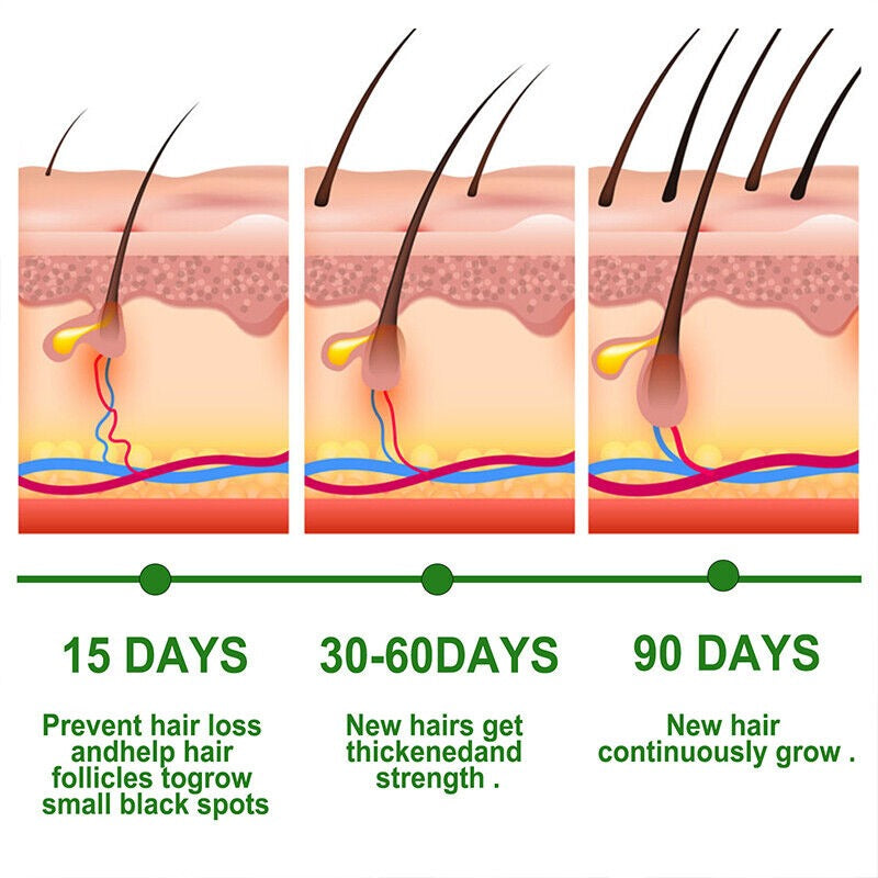 ANTI HAIR LOSS OIL (30ML)