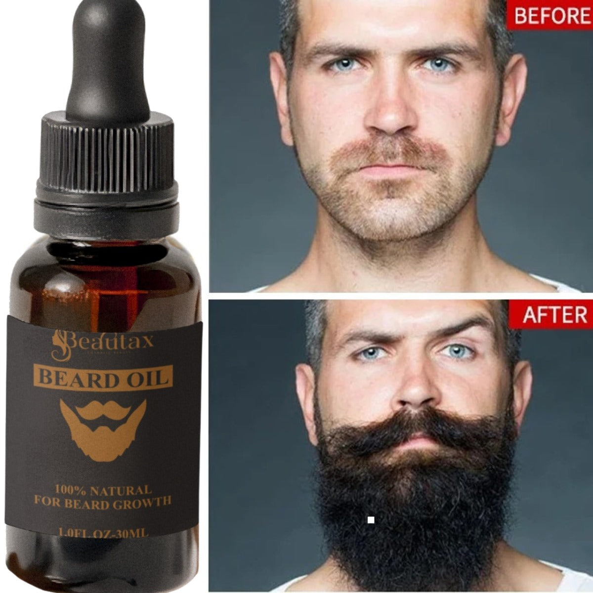 BEARD GROWTH OIL (30ML)